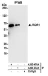 Detection of human WDR1 by western blot of immunoprecipitates.