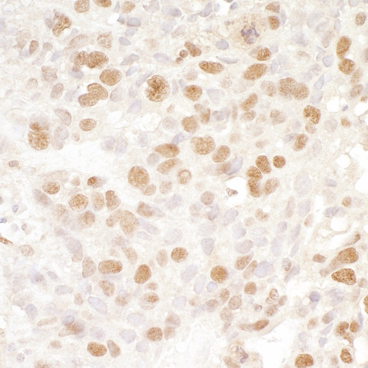 Rabbit anti-BRD4 IHC Antibody