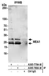 Detection of human MEA1 by western blot of immunoprecipitates.