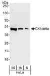 Detection of human CKI delta by western blot.