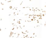 Detection of human IGF1R by immunocytochemistry.