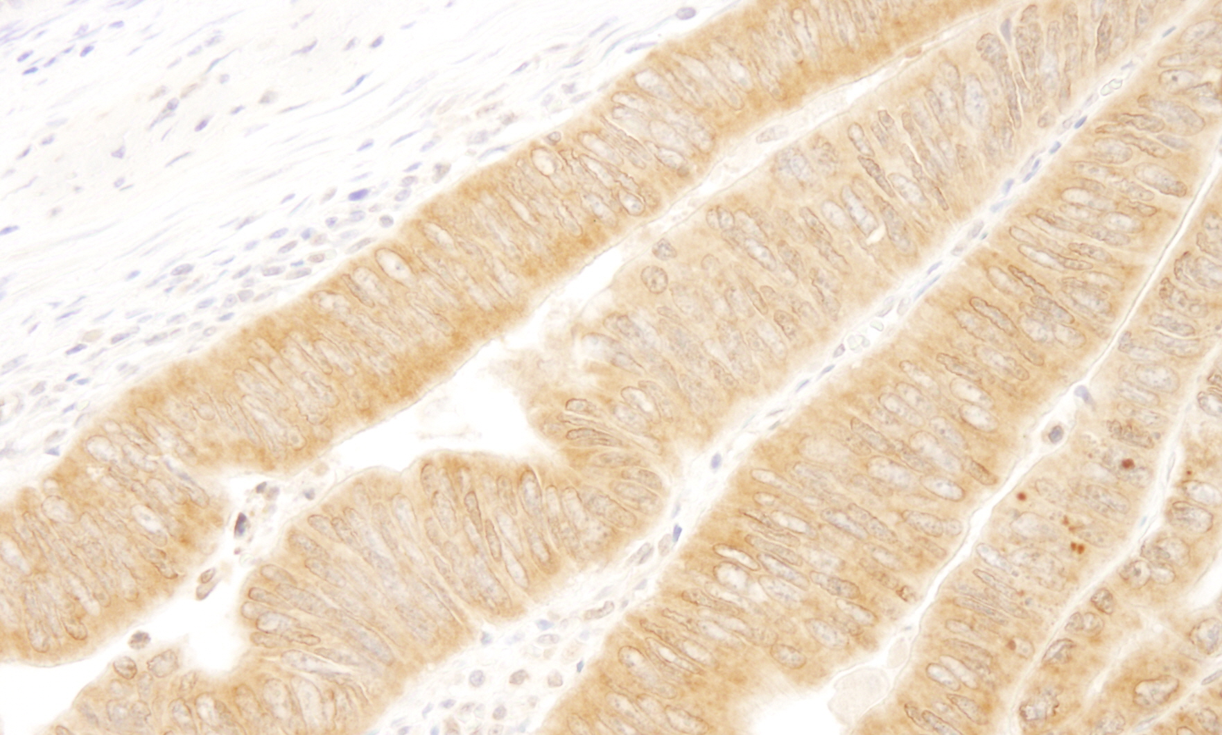 Rabbit anti-UVRAG IHC Antibody