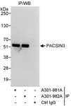 Detection of human PACSIN3 by western blot of immunoprecipitates.
