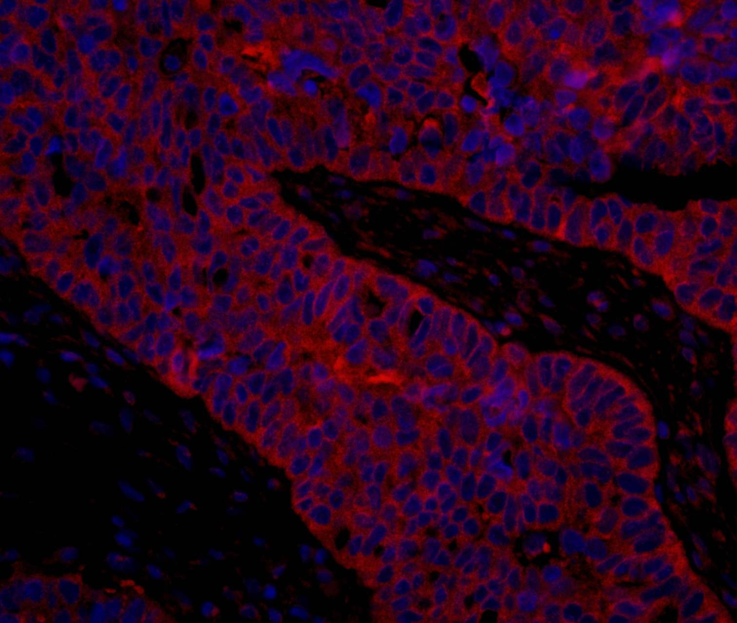 Rabbit anti-eIF3B/EIF3S9 IHC Antibody