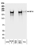 Detection of human NF-H using mouse anti-chicken IgY secondary antibody by western blot.