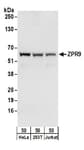 Detection of human ZPR9 by western blot.