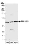 Detection of human PPP1R21 by western blot.