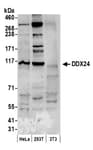 Detection of human DDX24 by western blot.