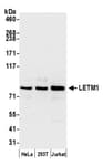 Detection of human LETM1 by western blot.
