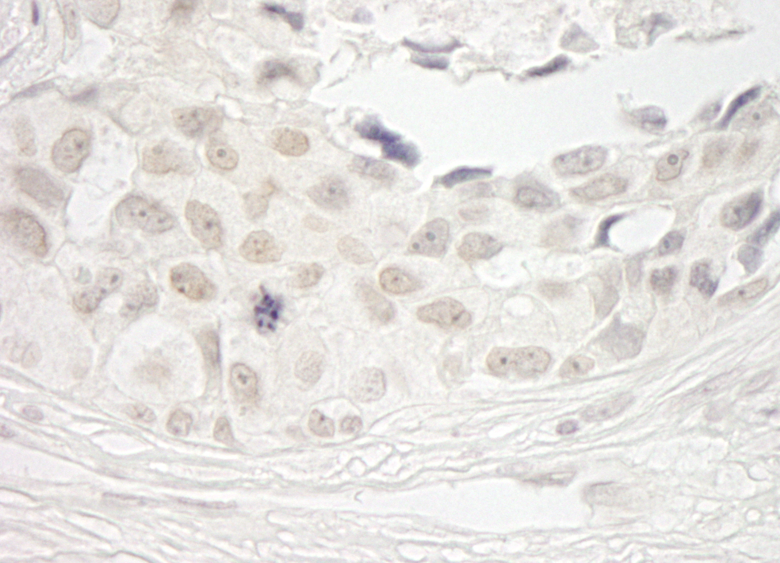 Rabbit anti-PPP1CB IHC Antibody