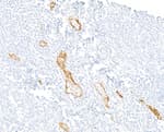 Detection of human P-Selectin/CD62P by immunohistochemistry.