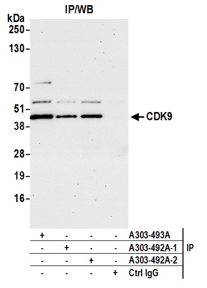 Detection of human CDK9 by western blot of immunoprecipitates.