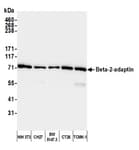Detection of mouse Beta-2-adaptin by western blot.