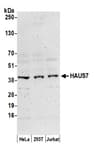 Detection of human HAUS7 by western blot.