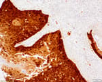 Detection of human p16INK4a by immunohistochemistry.