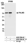 Detection of human PALMD by western blot of immunoprecipitates.
