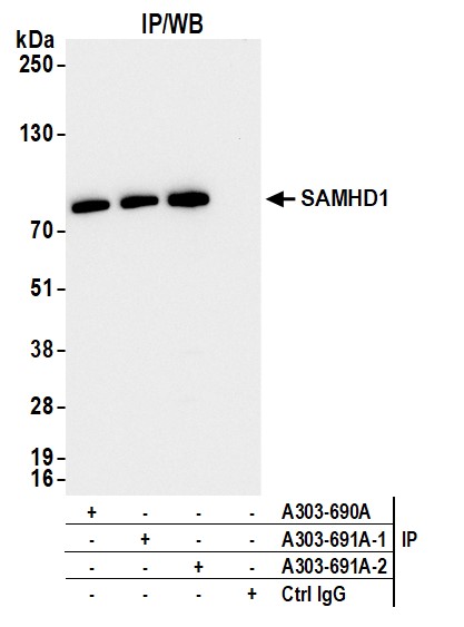 Detection of human SAMHD1 by western blot of immunoprecipitates.