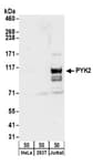 Detection of human PYK2 by western blot.