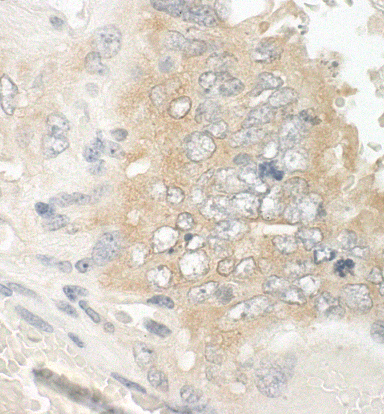 Detection of mouse EB1 by immunohistochemistry.
