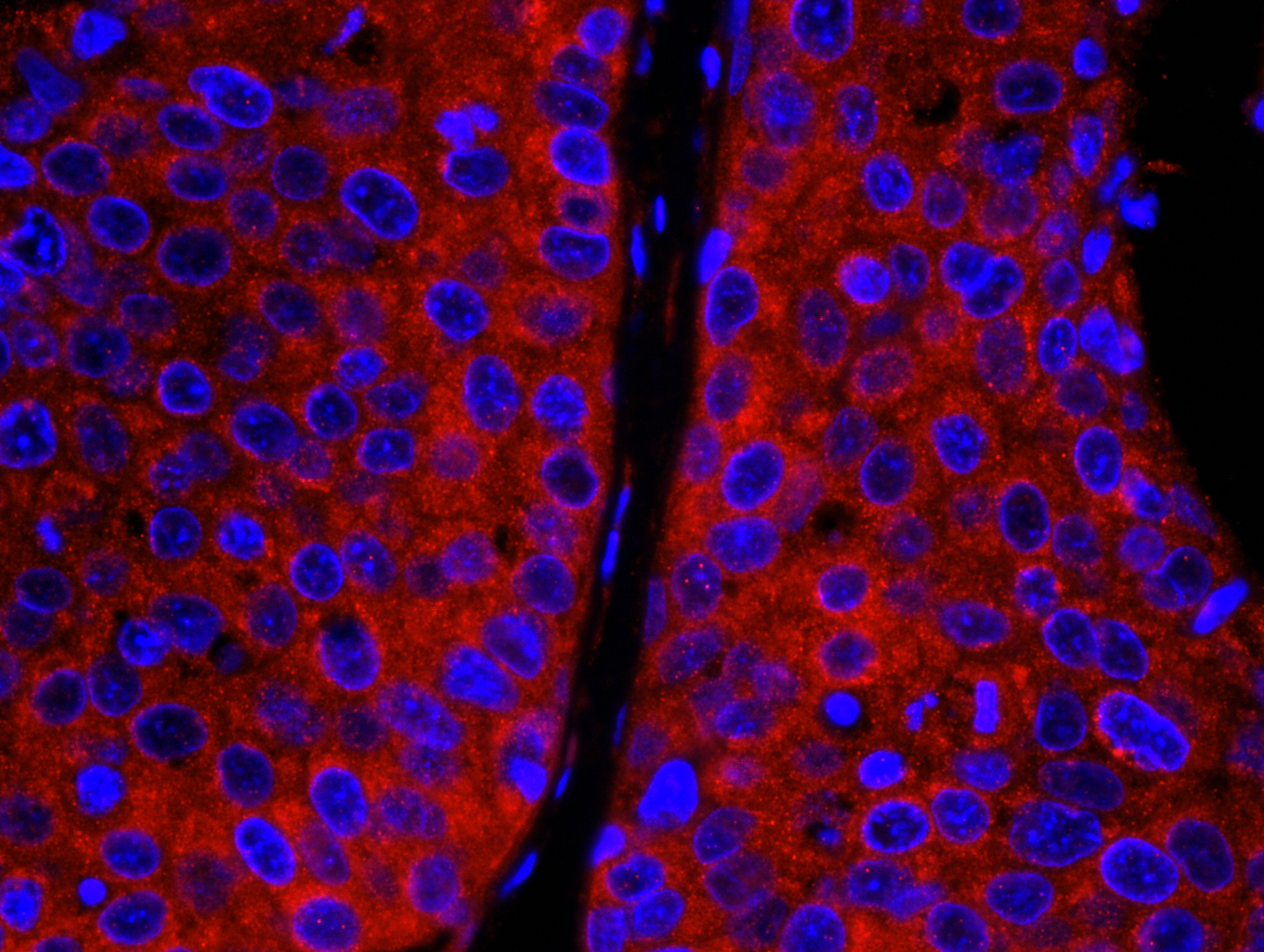 Rabbit anti-CAD IHC Antibody