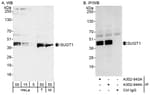 Detection of human and mouse Sgt1 (SUGT) by western blot (h&amp;m) and immunoprecipitation (h).