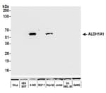 Detection of human ALDH1A1 by western blot.