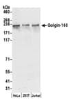 Detection of human Golgin-160 by western blot.
