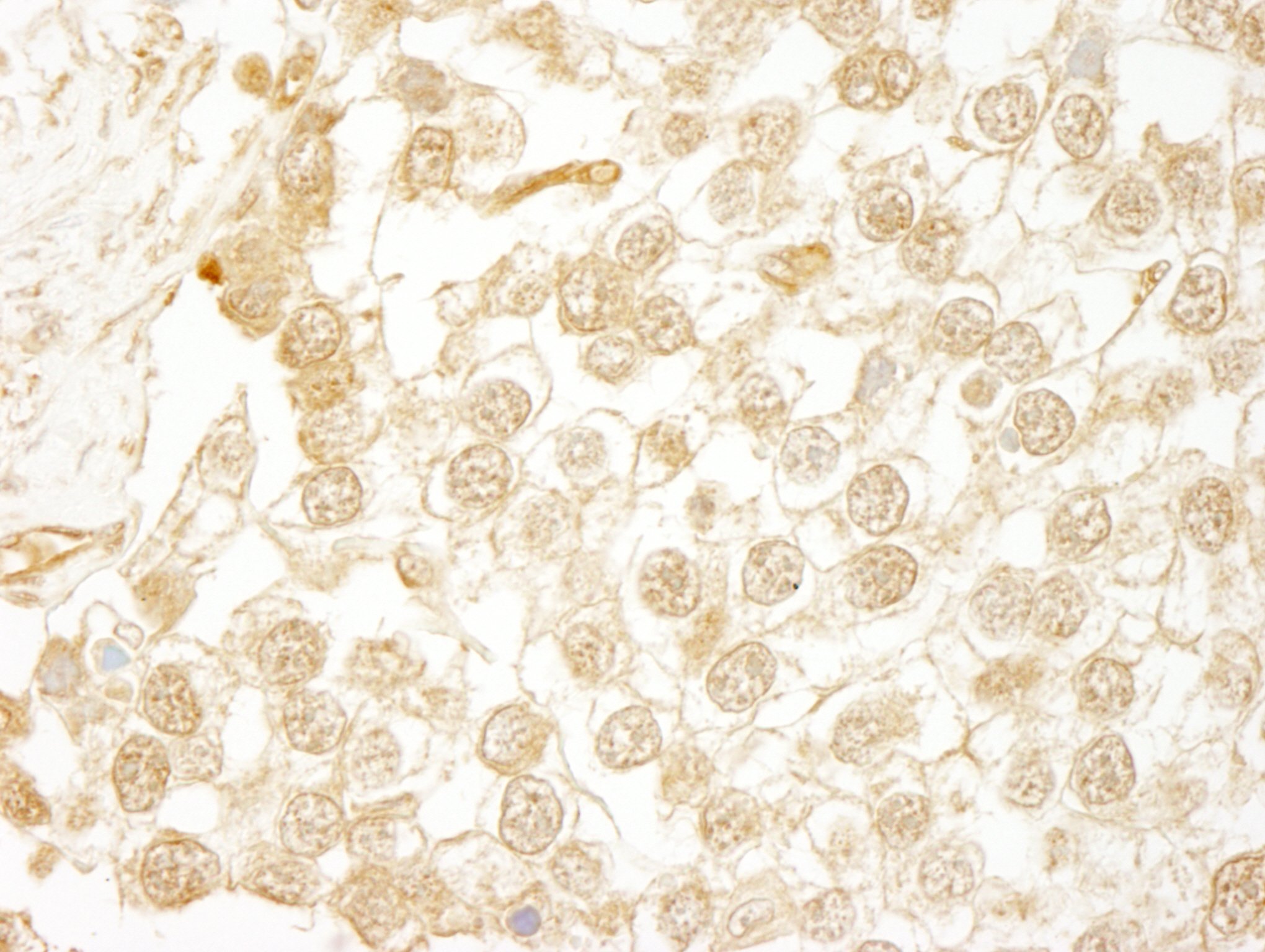 Rabbit anti-WDR20 IHC Antibody