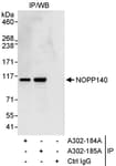 Detection of human NOPP140 by western blot of immunoprecipitates.