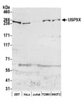 Detection of human and mouse USP9X by western blot.