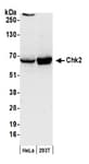 Detection of human Chk2 by western blot.