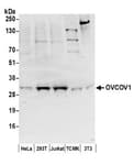 Detection of human and mouse OVCOV1 by western blot.