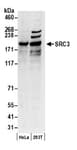 Detection of human SRC3 by western blot.