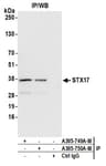 Detection of human STX17 by western blot of immunoprecipitates.