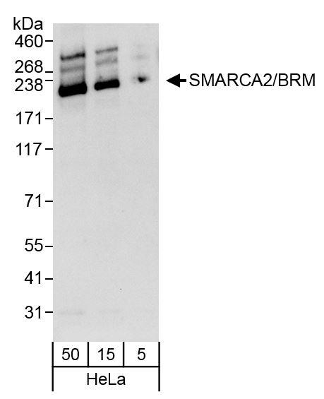 Detection of human SMARCA2/BRM by western blot.