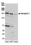 Detection of human Atrophin 1 by western blot.