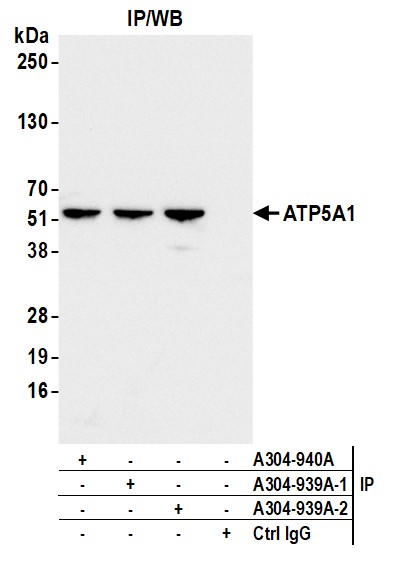 Detection of human ATP5A1 by western blot of immunoprecipitates.