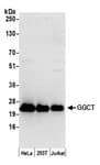 Detection of human GGCT by western blot.