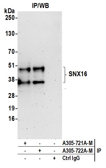 Detection of human SNX16 by western blot of immunoprecipitates.