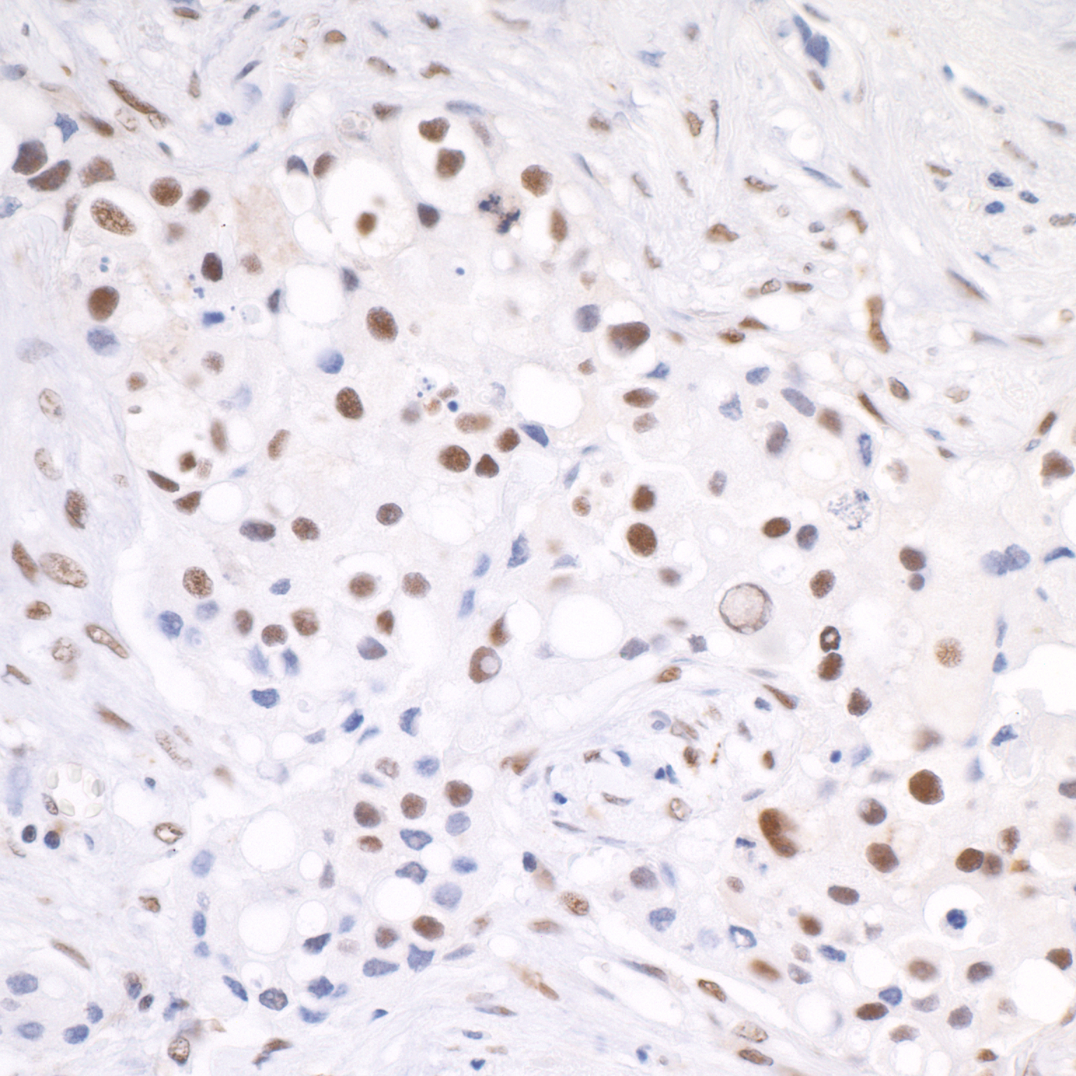 Detection of human CSTF64 by immunohistochemistry.