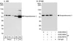 Detection of human and mouse Sequestosome-1 by western blot (h&amp;m) and immunoprecipitation (h).