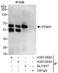 Detection of human STAM1 by western blot of immunoprecipitates.