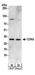 Detection of human CDK4 by western blot.