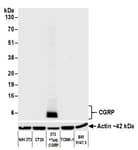 Detection of mouse CGRP by western blot.