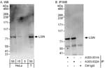 Detection of human LGN by western blot and immunoprecipitation.