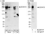 Detection of human and mouse ZC3H13 by western blot (h&amp;m) and immunoprecipitation (h).