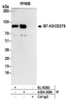 Detection of human B7-H3/CD276 by western blot of immunoprecipitates.