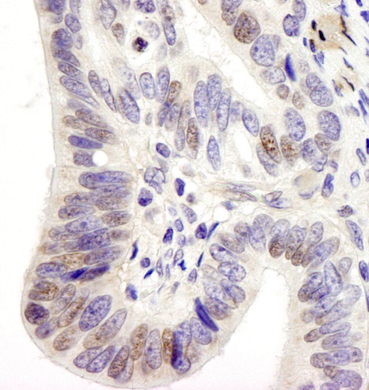 Detection of human USP28 by immunohistochemistry.
