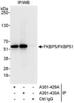 Detection of human FKBP5/FKBP51 by western blot of immunoprecipitates.