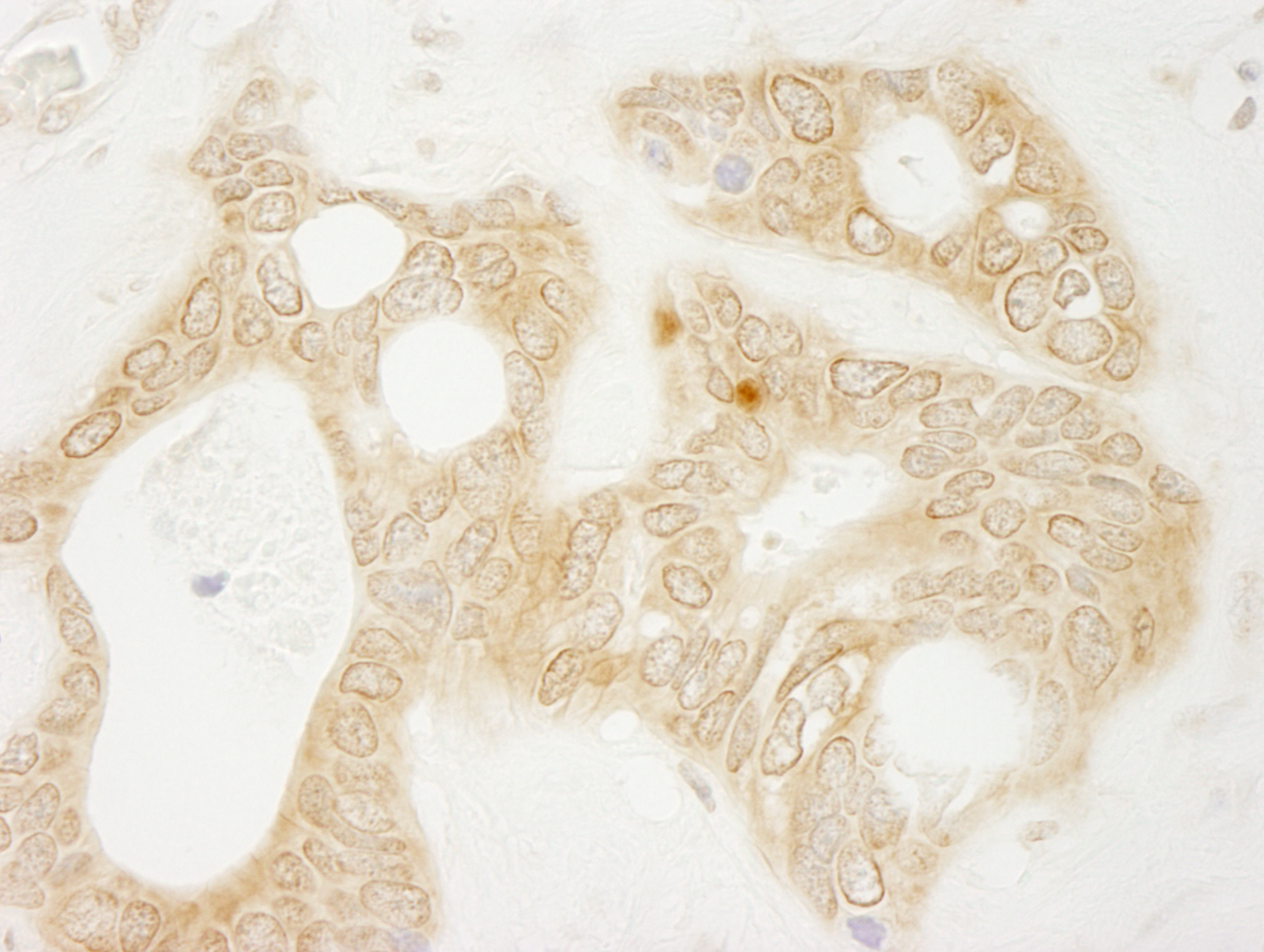 Rabbit anti-vPARP IHC Antibody